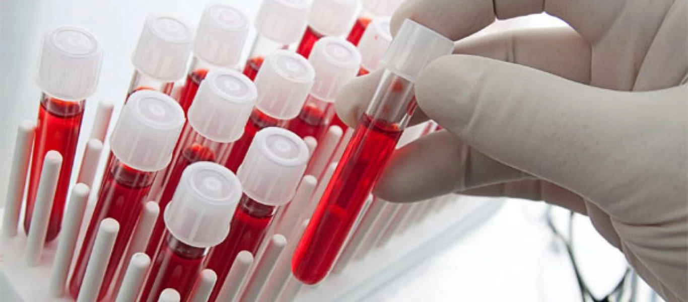 Φερριτίνη – Τιμές αναφοράς: Τι δείχνουν τα αυξημένα ή μειωμένα επίπεδα στο αίμα